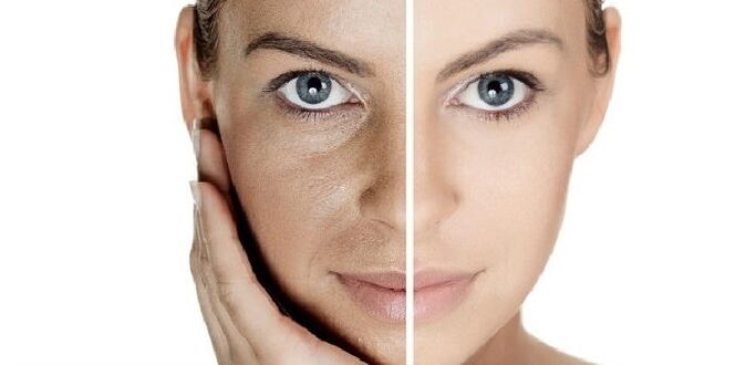 antes e despois do rexuvenecemento da pel facial