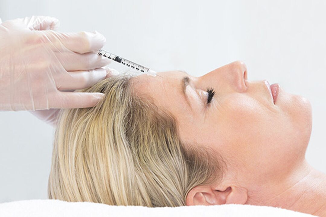 O plasmolifting é un método de inxección para rexuvenecer a pel da cara